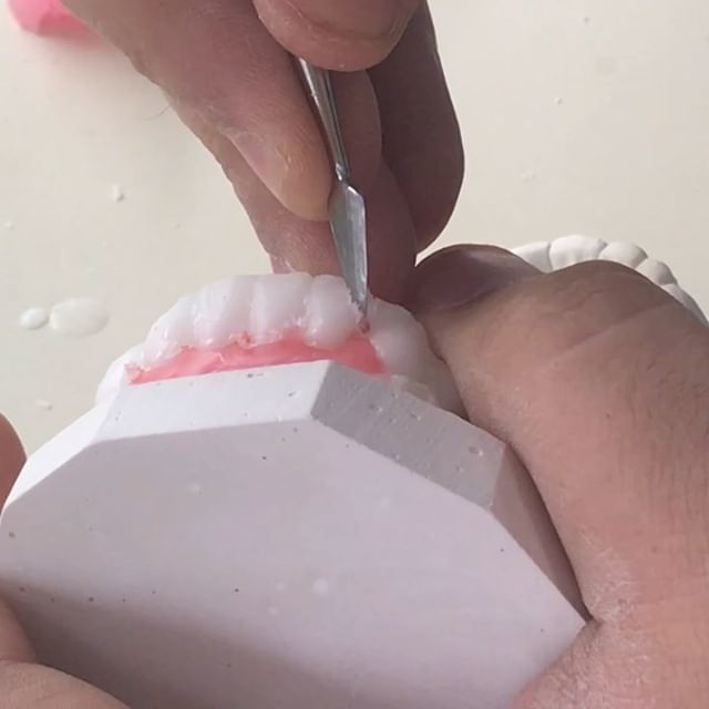  Profile Photos of Dental Crowns Lab Newark N/A - Photo 3 of 5