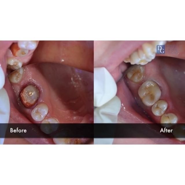  Profile Photos of Dental Crowns Lab Newark N/A - Photo 2 of 5