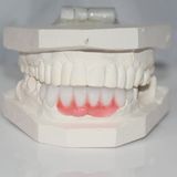Dental Crowns Lab Newark, Newark