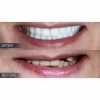  Dental Crowns Lab Serving 