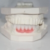 Dental Crowns Lab, Staten Island