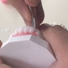Dental Crowns Lab, Staten Island