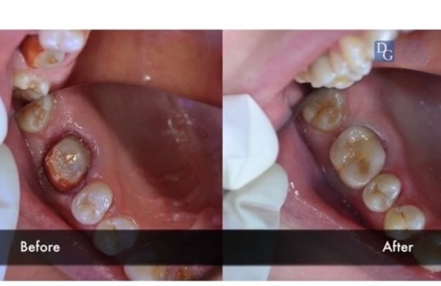  New Album of Dental Crowns Lab NYC N/A - Photo 4 of 8