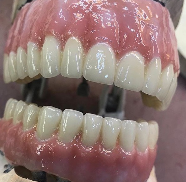  New Album of Dental Crowns Lab NYC N/A - Photo 5 of 8