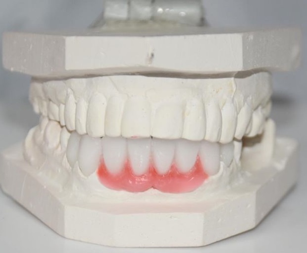  New Album of Dental Crowns Lab NYC N/A - Photo 8 of 8