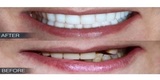  Dental Crowns Lab NYC N/A 