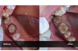  Dental Crowns Lab NYC N/A 