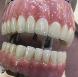 Dental Crowns Lab NYC, New York
