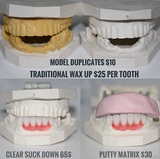 Dental Crowns Lab NYC, New York