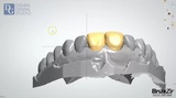 Dental Crowns Lab NYC, New York