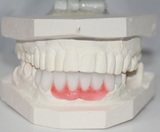 Dental Crowns Lab NYC, New York
