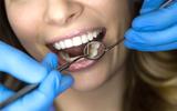 Affordable Dental Implants Albany, Albany