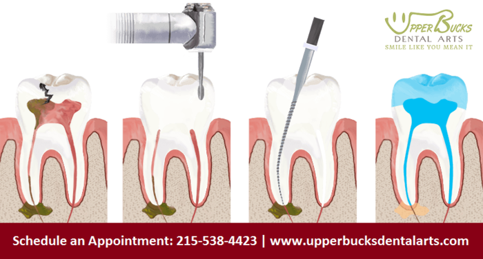  New Album of Upper Bucks Dental Arts 2100 Quaker Pointe Dr Suite 3, Quakertown, PA 18951, USA, https://www.upperbucksdentalarts.com/ - Photo 1 of 10