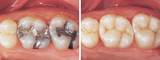  Upper Bucks Dental Arts 2100 Quaker Pointe Dr Suite 3, Quakertown, PA 18951, USA, https://www.upperbucksdentalarts.com/ 