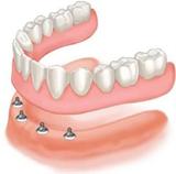 Dentists Near Me, Delmar