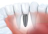 Dentists Near Me, Delmar