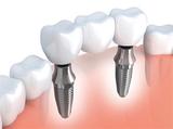 Dentists Near Me, Delmar