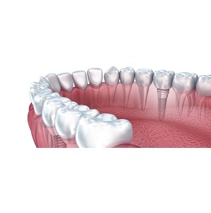  Profile Photos of Connecticut Ave. Cosmetic Dentistry 4444 Connecticut Ave NW #106 - Photo 1 of 5