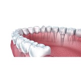  Connecticut Ave. Cosmetic Dentistry 4444 Connecticut Ave NW #106 