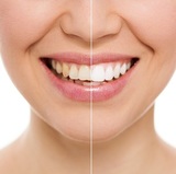 Connecticut Ave. Cosmetic Dentistry, Washington